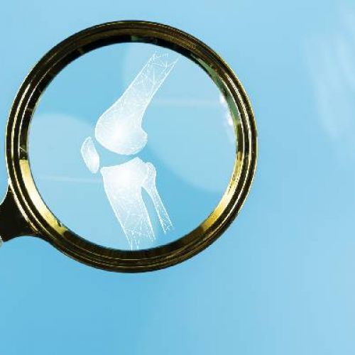 Cam Kemik Hastalığı (Osteogenezis İmperfekta)