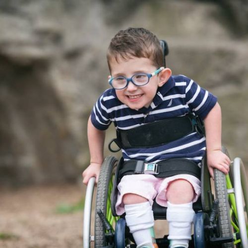 Spina Bifida Nedir? Belirtileri ve Rehabilitasyon Destek Programı
